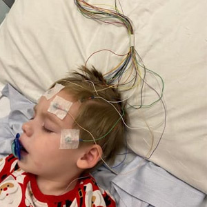 Encephalitis treatment in Malleshwaram